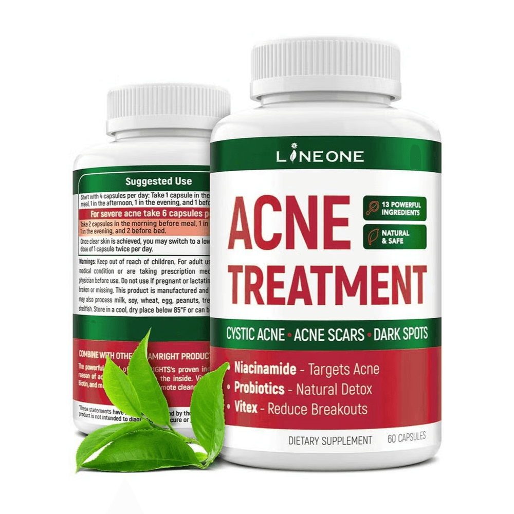 Norland Line One Acne Treatment supplement Uganda UGX 70,000