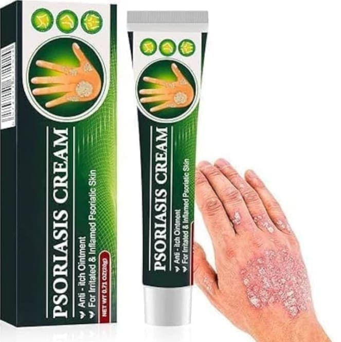 Norland Psoriasis Cream supplement Uganda UGX 25,000